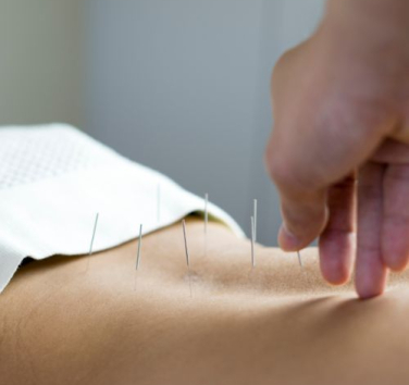 acupuncture et cbd